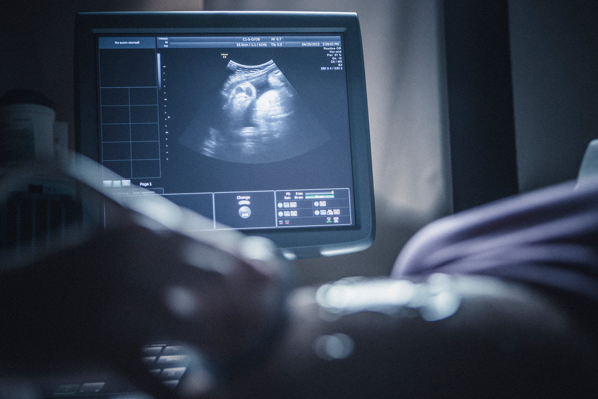 Ultrasound imaging in a premium clinical setting